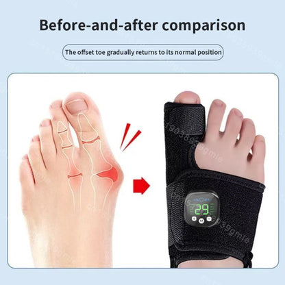 StepAlign™ Bunion Corrector – Orthopedic Toe Separator & Thumb Adjuster